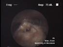 Inside Steve Sklar&#039;s Larynx: Kargyraa