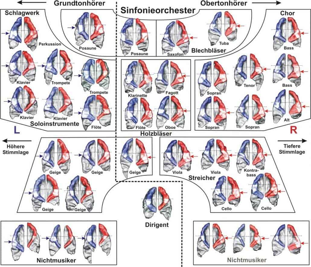 Overtone and fundamental pitch listeners in the orchestra (c) Neurological University Hospital Heidelberg